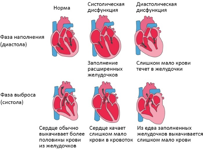 A heart. Where is a person, woman, man, anatomy, structure, function, disease