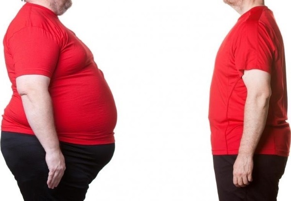 Resection of the stomach for weight loss. The price, as is the procedure, types of obesity, diet after