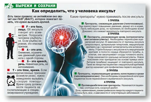 kako prepoznati moždani udar