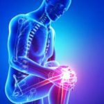 Como aliviar a dor no joelho