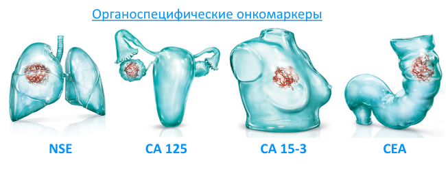 De norm van CA-125 voor cysten van de eierstokken
