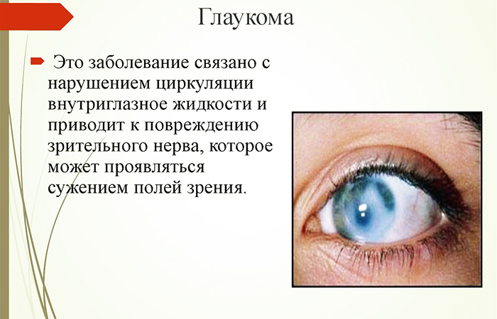 Ciprofloxacine oogdruppels. Gebruiksaanwijzing, beoordelingen