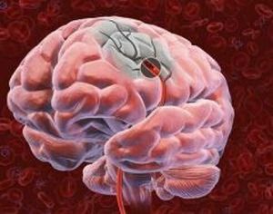 Localizarea zonei în creier