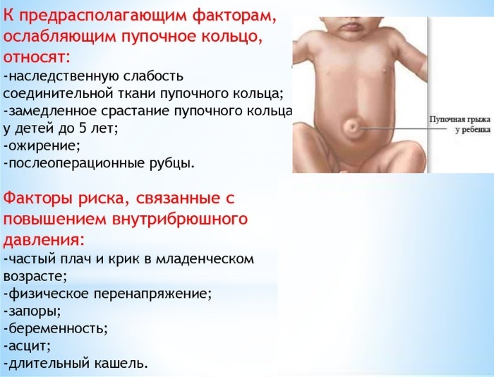 Umbilical brok hos børn 5-6-10 år. Fotos, symptomer, hvordan det ser ud, hvad der er farligt
