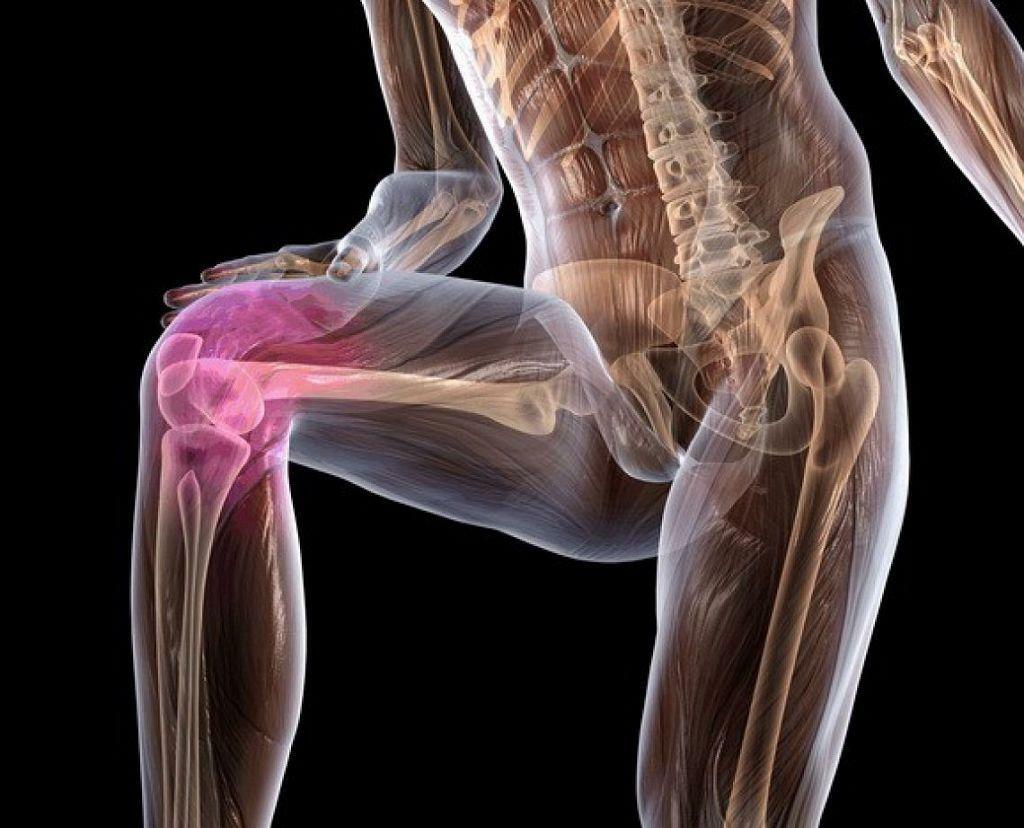 Chondromatoza articulației genunchiului