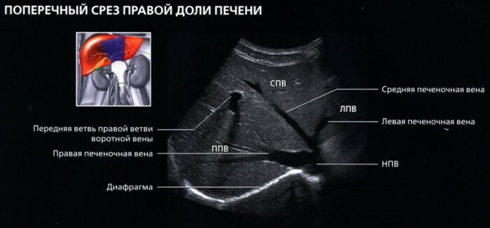 Segmentos de fígado em seções de ultrassom, tomografia computadorizada, ressonância magnética. Esquema, foto