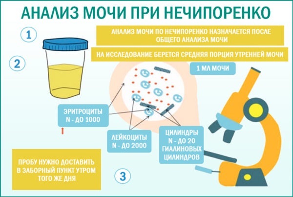 Urine for Nechiporenko. The norm for adults, children leukocytes / erythrocytes as pass, decoding