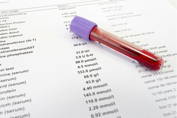 MID in the blood test is increased in a child, women, men