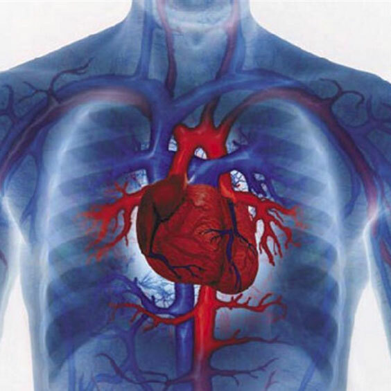 Sydän sydämen coronography( sydämen alukset)