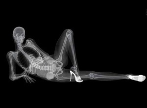 Röntgenfoto van de wervelkolom