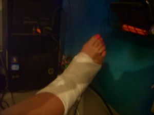 ankle bandage