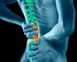 Radikulopatia lumbosakrálnej chrbtice