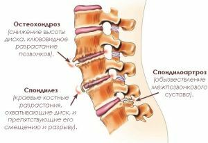 patologické stavy chrbta