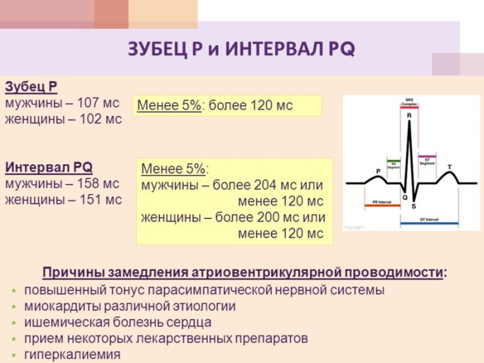 PQ -förkortning på EKG. Vad betyder det