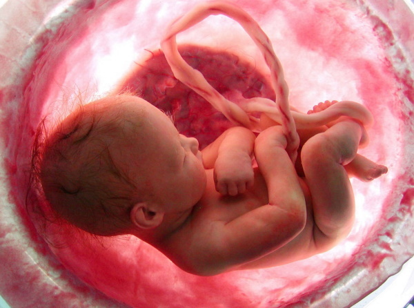 Fetalne stiske med porodom. Kaj je to, posledice