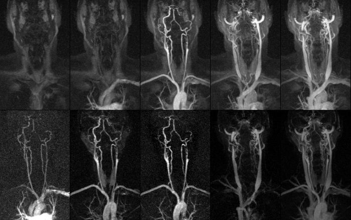 Contrast with MRI. What is it, contraindications, complications, types that are administered
