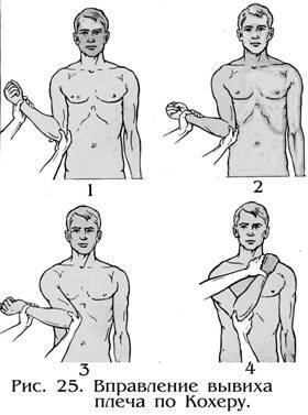 Luxación de la articulación del hombro. Tratamiento, rehabilitación, ejercicio, síntomas, primeros auxilios, radiografía