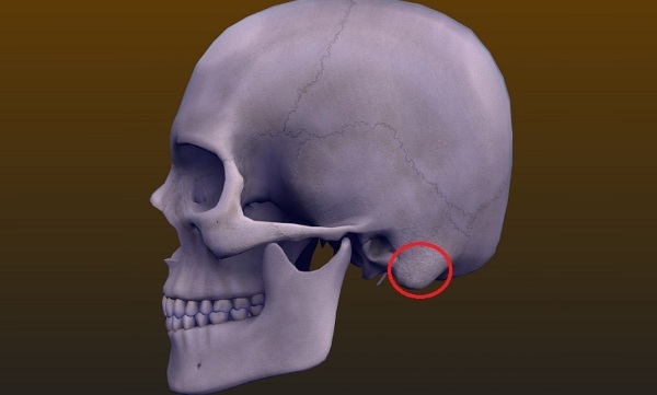 Mastoid. Where is it, what is it, photos, types of structure, inflammation, fracture, cholesteatoma, cell sclerosis
