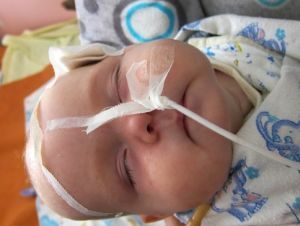 ventrikulitida u novorozenců