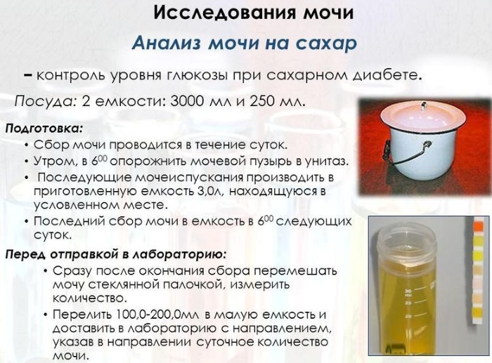 Daily urine. How to collect protein, sugar, cortisol, calcium for analysis