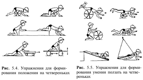 Exercise therapy for cerebral palsy. A set of exercises