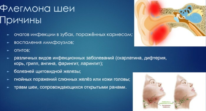 Kadik for women. Causes of appearance, photo of ultrasound, structure