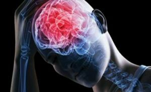 galvos smegenų trauma ir dusulys