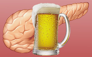 Alcoholische pancreatitis