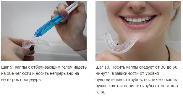 Blanchiment des dents à domicile avec protège-dents. Avis, prix
