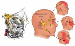 What characterizes neuralgia of the trigeminal nerve: how to identify the causes and symptoms, treatment of the disease