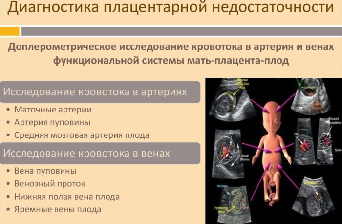 1a / b KMT pažeidimas nėštumo metu. Kas tai yra