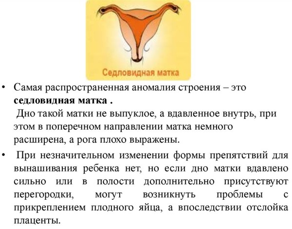 Saddle uterus. What is it, what does it mean during pregnancy, treatment