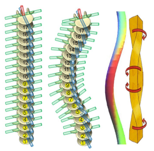 Kelengkungan vertebra