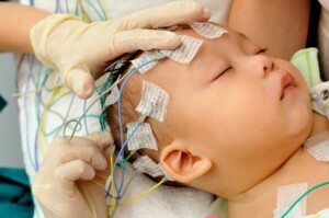 EEG of the baby
