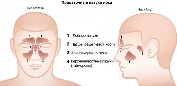Assombrissement subtotal des sinus maxillaires. Qu'est-ce que c'est, comment traiter chez un enfant avec et sans liquide, niveau horizontal, vertical