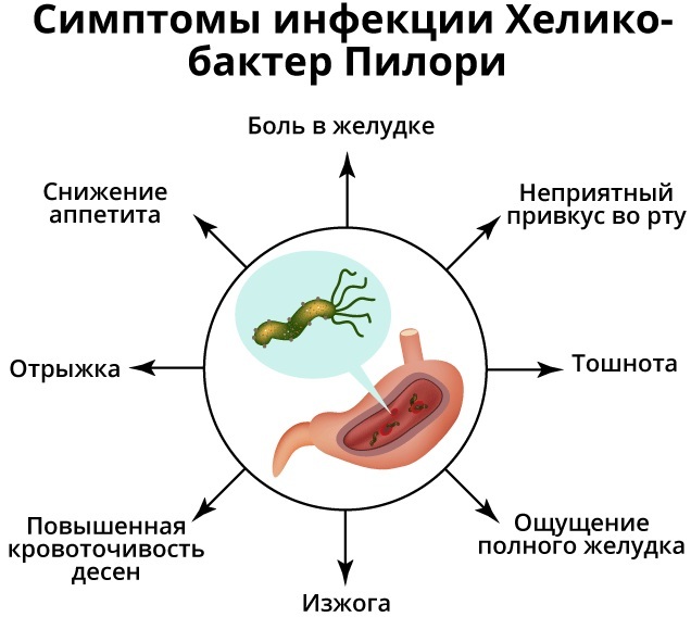 Helicobacter pylori -bakterier i magen. Hvordan behandles med medisiner