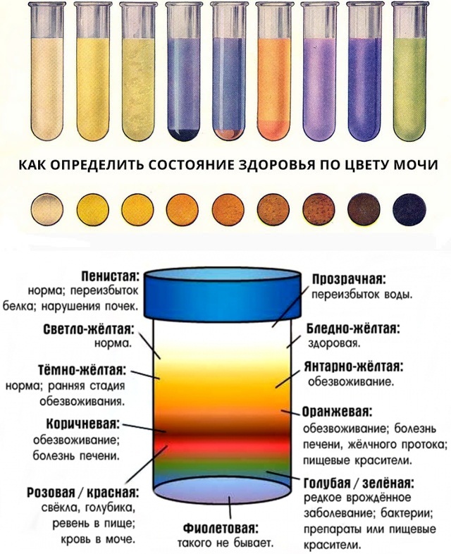 The urine is orange in women. Reasons with and without smell, what is it during pregnancy, cystitis, ARVI, treatment