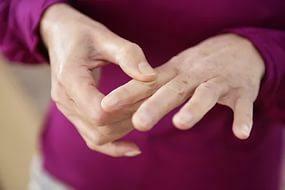 Manifestations of arthritis
