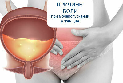 Oorzaken van pijn bij het urineren bij vrouwen