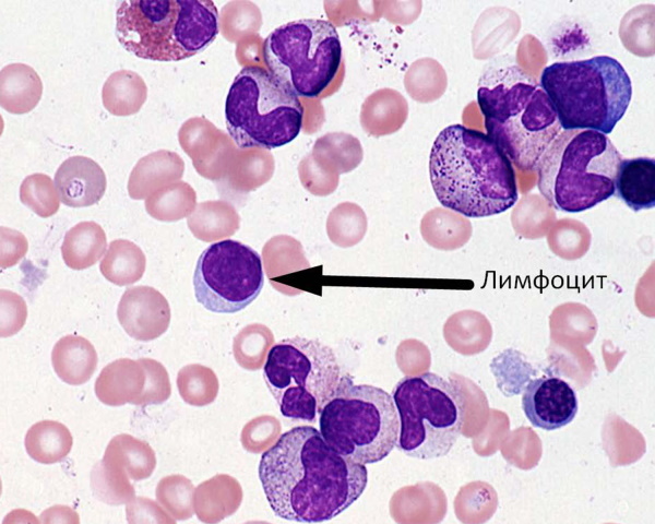 Lymphocytes are lowered during pregnancy 1-2-3 trimester