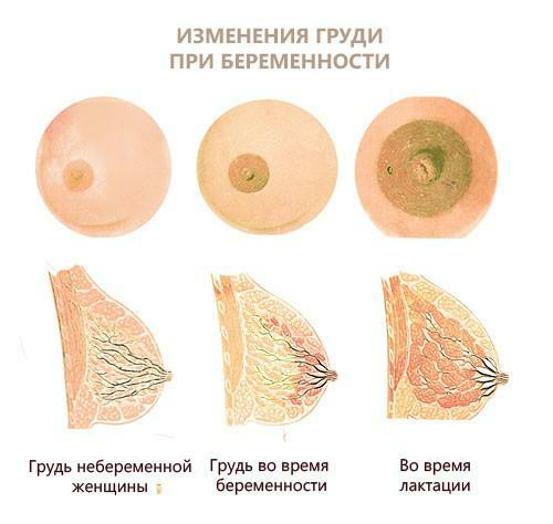 Aumento del seno durante la gravidanza