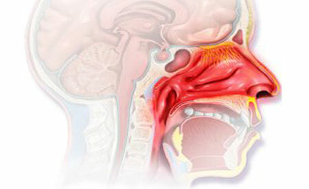Årsaker til nasal oppstramming uten forkjølelse, behandlingsmetoder