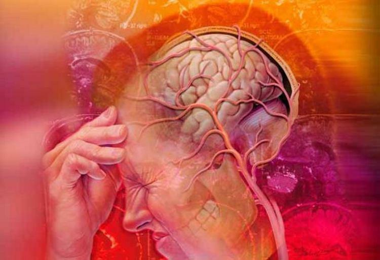 Kohdunkaulan migreeni ja sen ilmenemismuodot