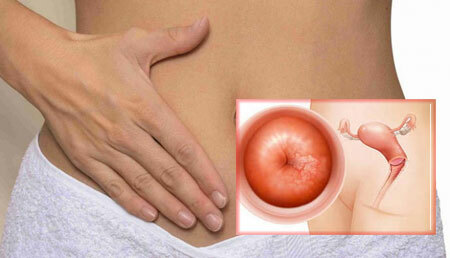 Tratamento da erosão cervical