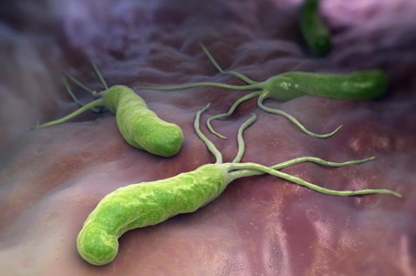 Helicobacter pylori bacteria in the stomach. How to treat with medication
