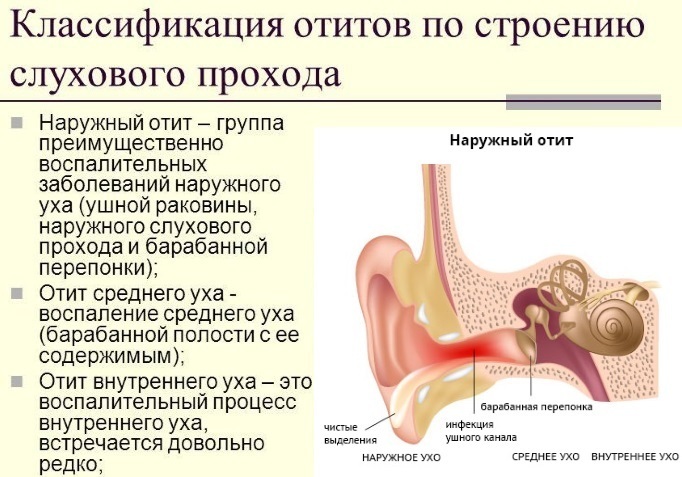 Ear infection. Symptoms and home treatment. Medicines, drugs, folk methods, antibiotics