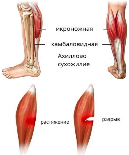 Muscle pain throughout the body. Causes and treatment