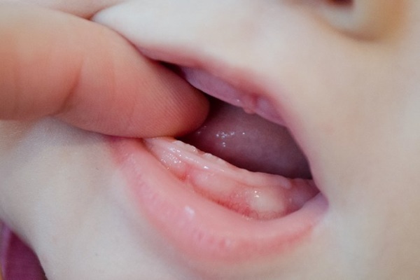Dantinorm Baby per la dentizione. Recensioni, istruzioni, analoghi