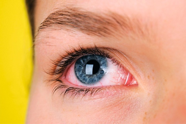 טיפות עיניים של Artelac Balance. מחיר, הוראות, אנלוגים