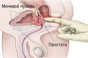 massage of the prostate